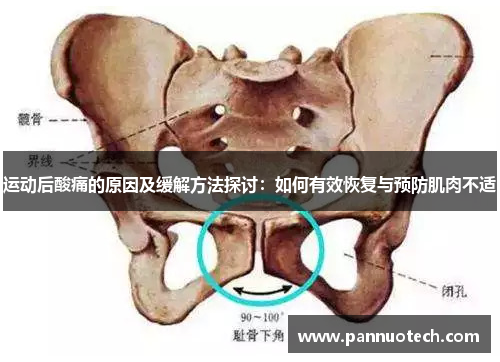 运动后酸痛的原因及缓解方法探讨：如何有效恢复与预防肌肉不适